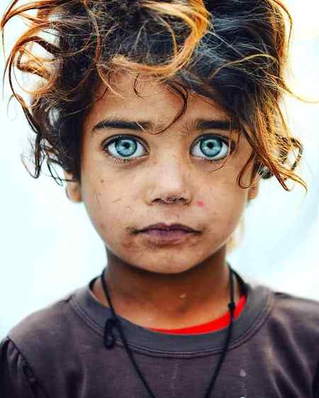Omg just look at her beauty and amazing gorgeous eyes.she is poor girl but she is cute