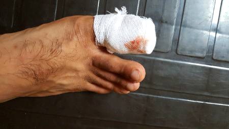 Zakham..... pain ....😭😢