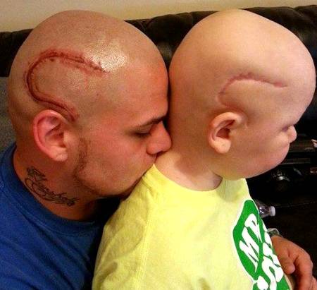 Father of the year gete tatto to match his son's surgery scar.