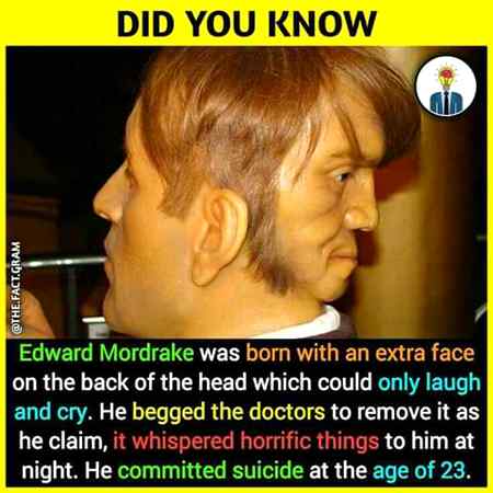 Amazing but horrible fact😱