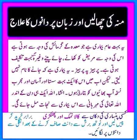 Totky nuqsaan b dy dety hn na kabhi kabhi