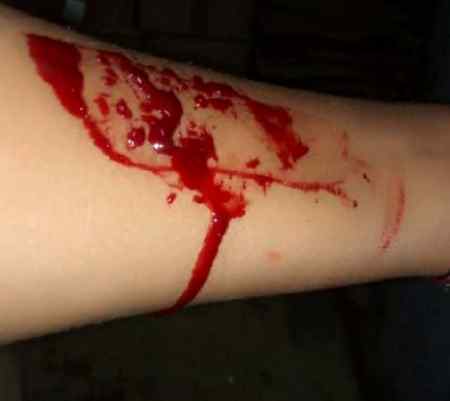 Jin ko dil mein rakhte Hain  wohi dil tod Jate hain.💘💔