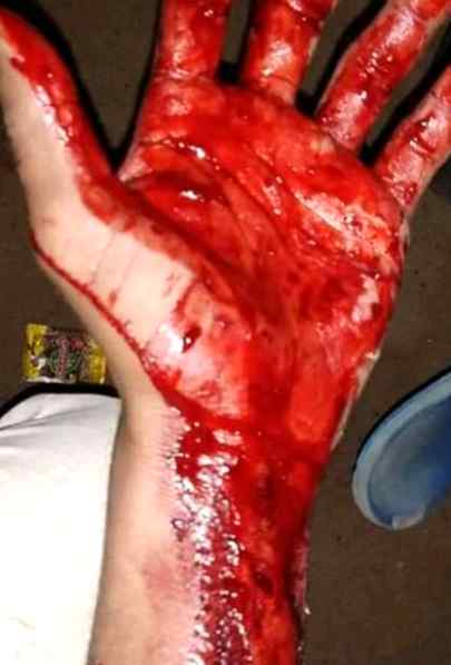 please friends pray for me yesterday  night i have mate with an accident