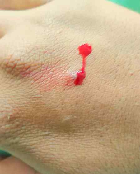 Subha subha hath kat giya😢