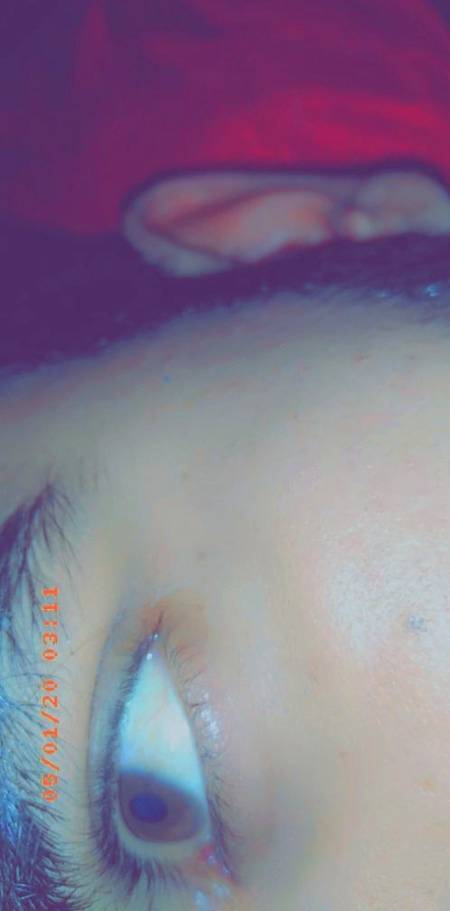One word for my eye jo full of pain hy
