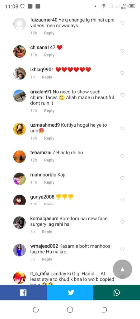 Hania Aamir Had Lip Fillers And People Can’t Digest It