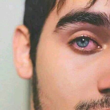 ارے نہیں بہت... خوش ہوں میں..
بس آپ...آنکھوں پے دھیان مت دیجیئے.
Chaand😥🙏