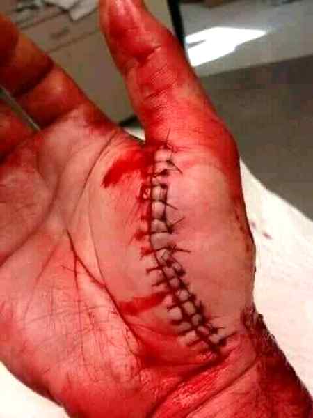 ہاتھ زخمی ہوئے تو کچھ اپنی ہی غلطی تھی
لکیروں کو مٹانے نکلے تھے کسی کوپانے کے لئے