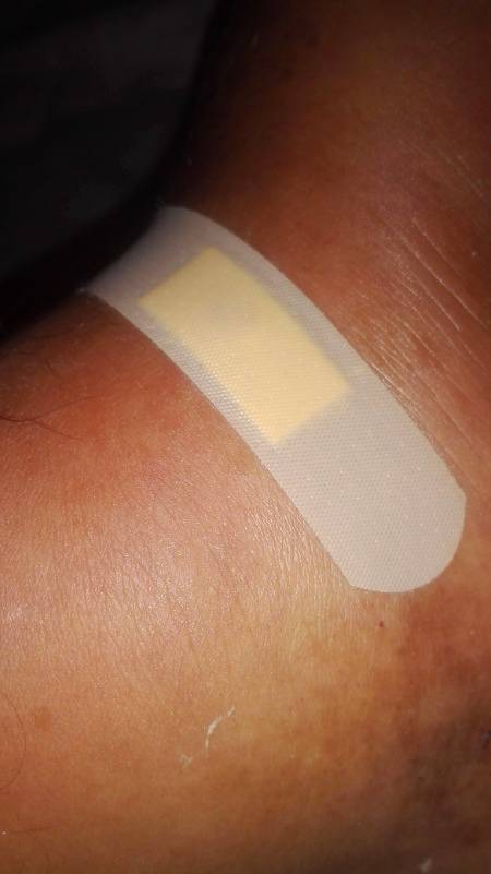 Nobody Care Only Father Care,s 🙂 Chot Mujy Lagyi Bandage Baba Ne Lagaya Dard Se Awaz Mari Nikli Mesus Baba Ko Hva 😫 Love You Baba 😘