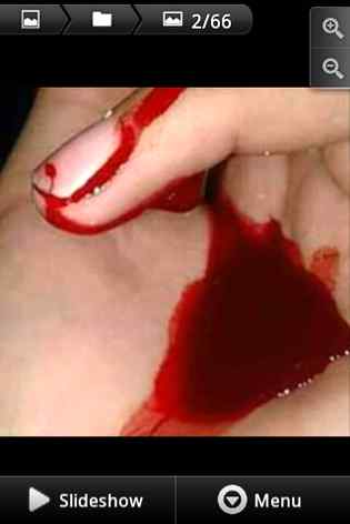 ڈوبی ہیں میری اُنگلیاں ہی میرے خُون سے___یہ کانچ کے ٹُکڑوں پر بھروسے کی سزا ھے