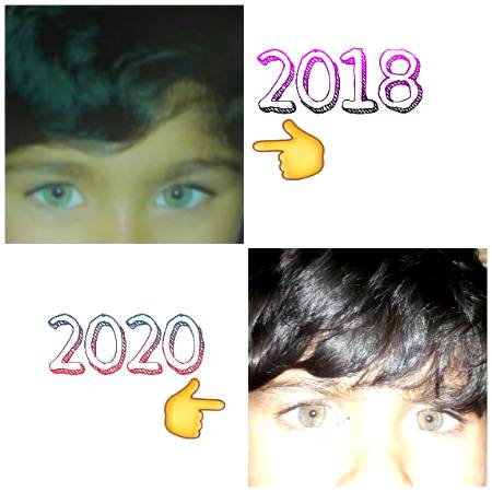 Beshuk!! Allah Is the best creator Younger bro😍,,Ignore his wound