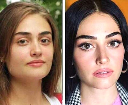 Before ---- After ( Esra Bilgiç ) 2012 ___ 2017 "look"