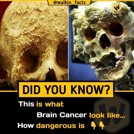 Did you Know