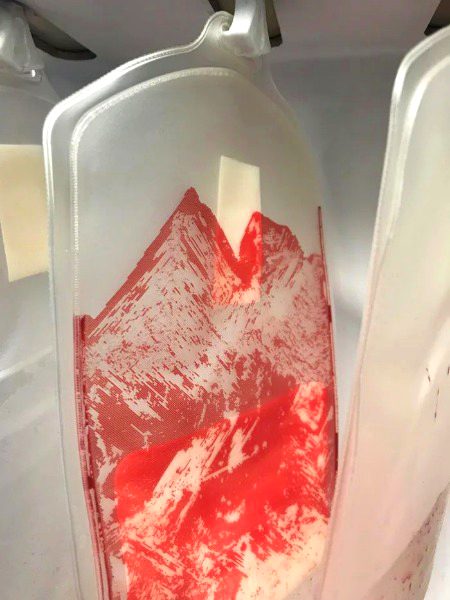 This blood bag that looks like a snowy mountain
