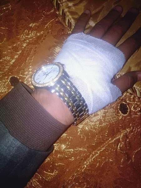 Ufff Ajj Phr Chot Lag Gai.j5.j3 Woh Bhe Itni Sardi Main.a6😨😰